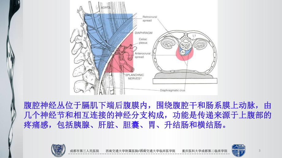 内镜超声引导下腹腔神经丛溶解术和阻滞术-ppt课件.ppt_第3页