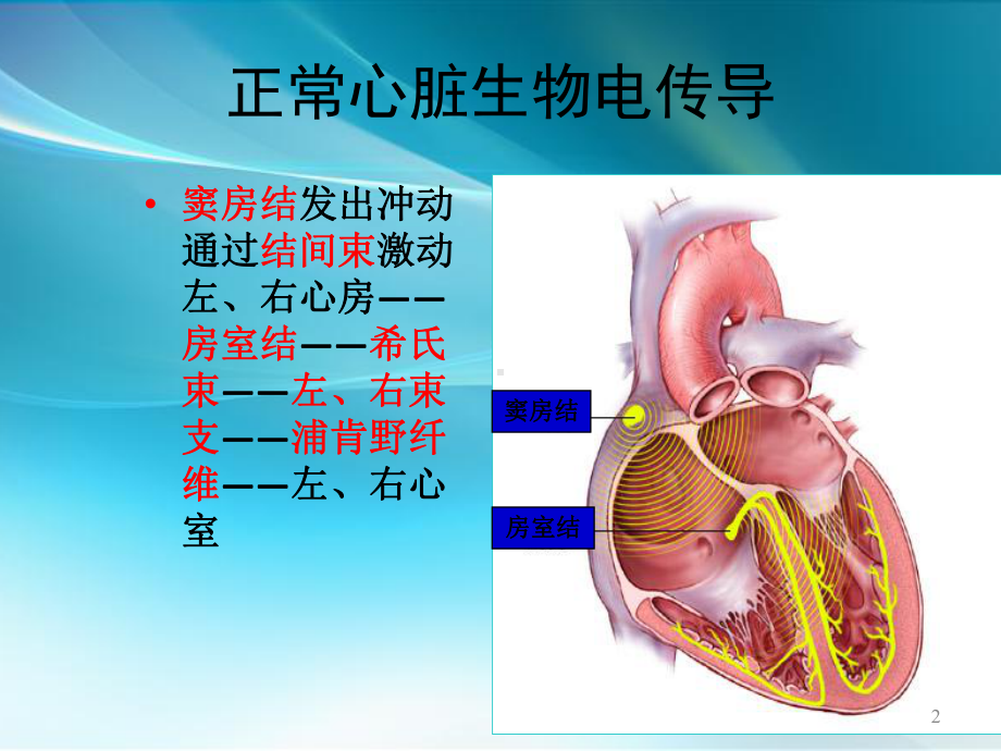 心脏起搏器简述PPT课件.ppt_第2页