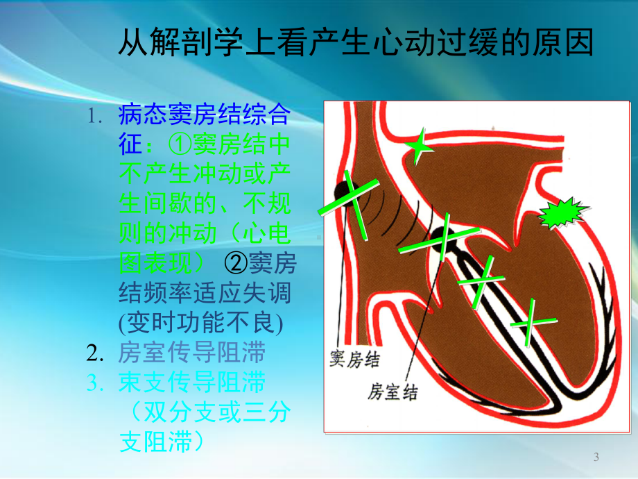 心脏起搏器简述PPT课件.ppt_第3页