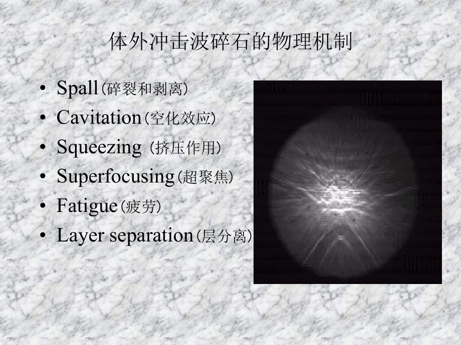 体外冲击波碎石的物理机制及生物效应-PPT课件.ppt_第3页