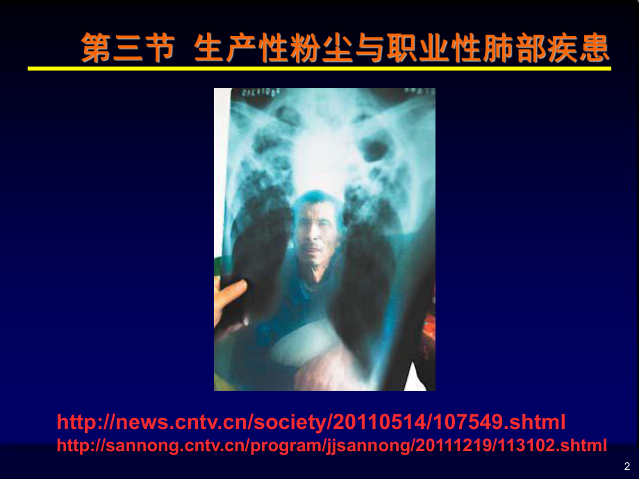 卫生学课件8.职业环境与健康-(二).ppt_第2页