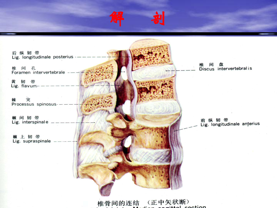 椎间盘突出的影像学表现ppt课件.ppt_第3页