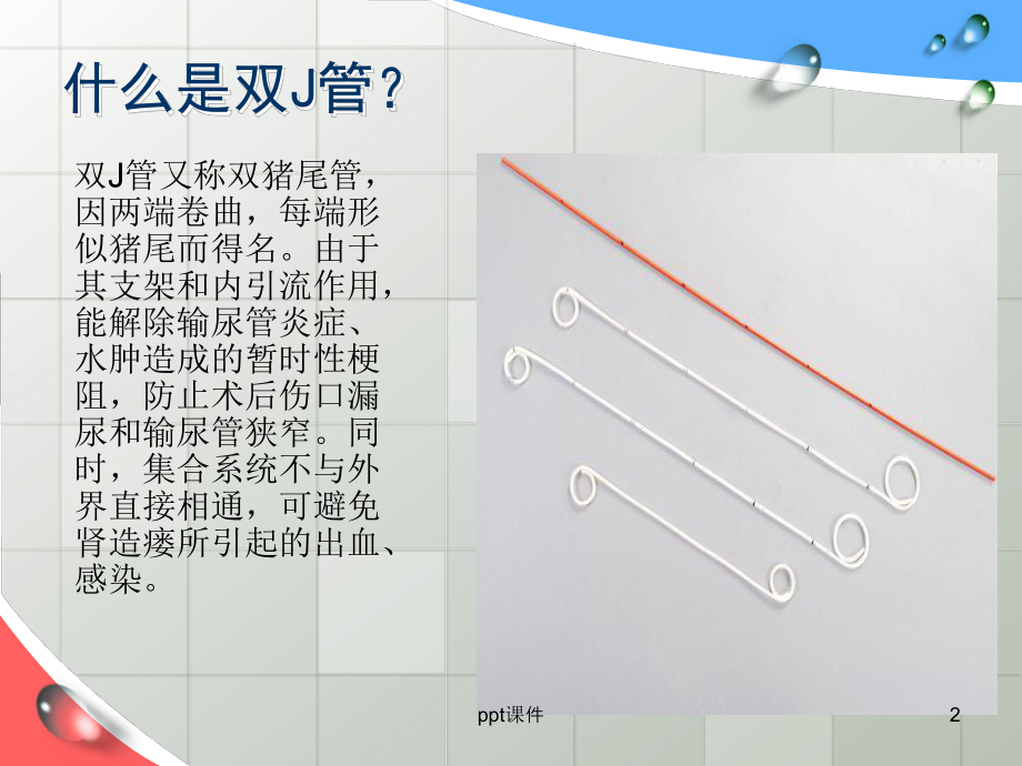 留置双J管的健康指导-ppt课件.ppt_第2页