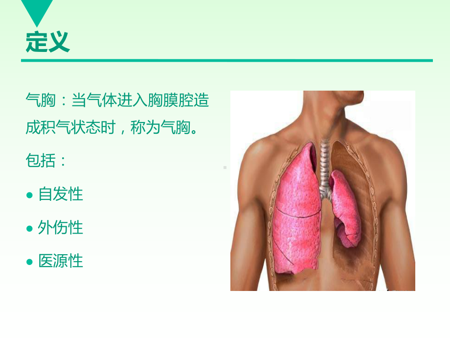 气-胸ppt课件.ppt_第2页