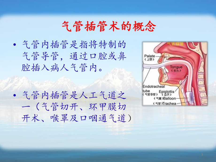 成人经口气管插管术PPT课件.ppt_第3页