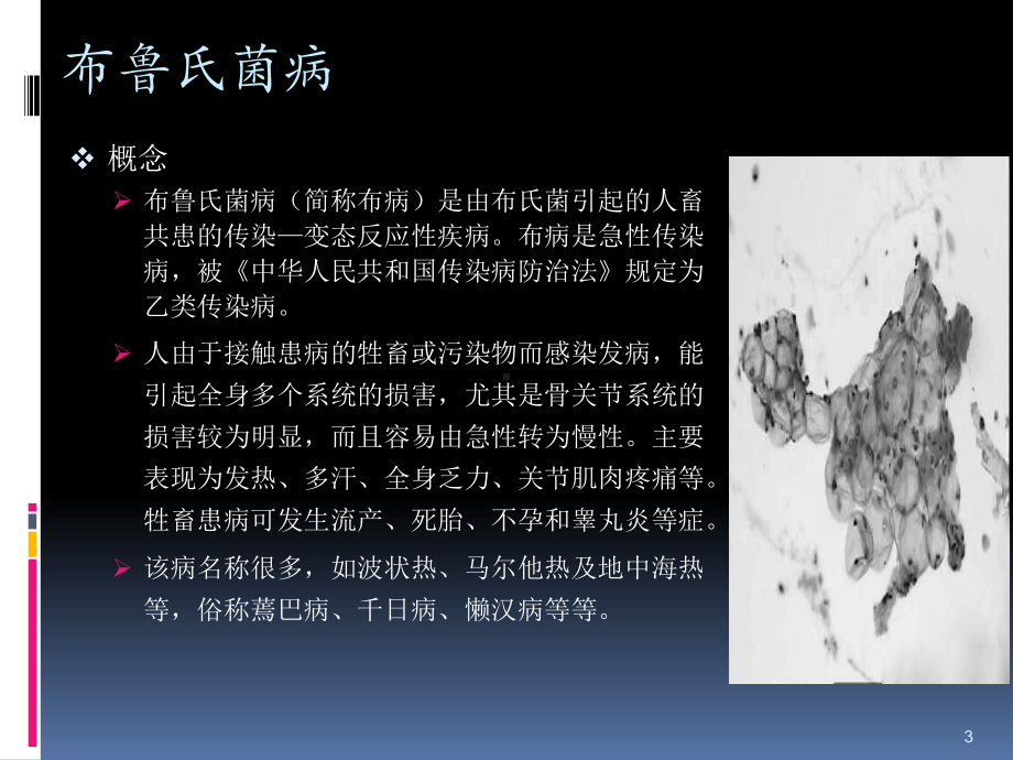 布鲁氏菌病PPT课件.ppt_第3页