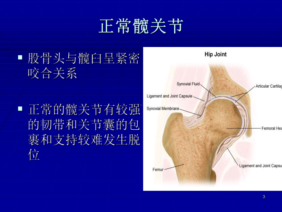 大龄儿童DDHPPT课件.ppt_第3页