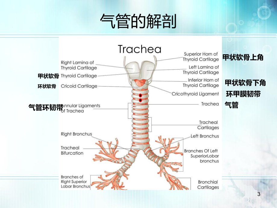 经皮气管切开PPT课件.ppt_第3页