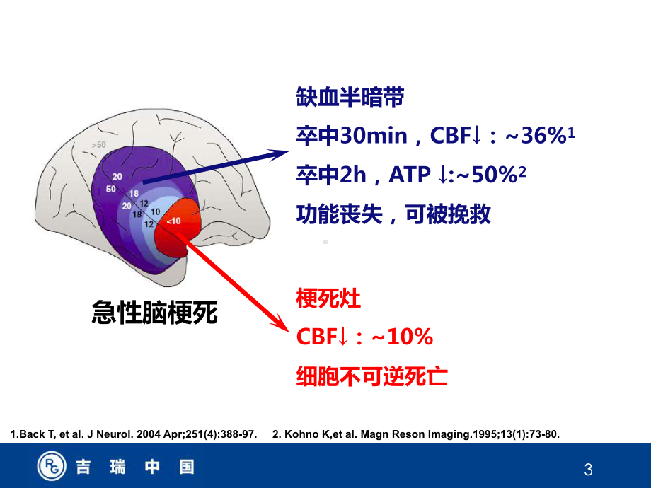 挽救缺血半暗带-ppt课件.ppt_第3页