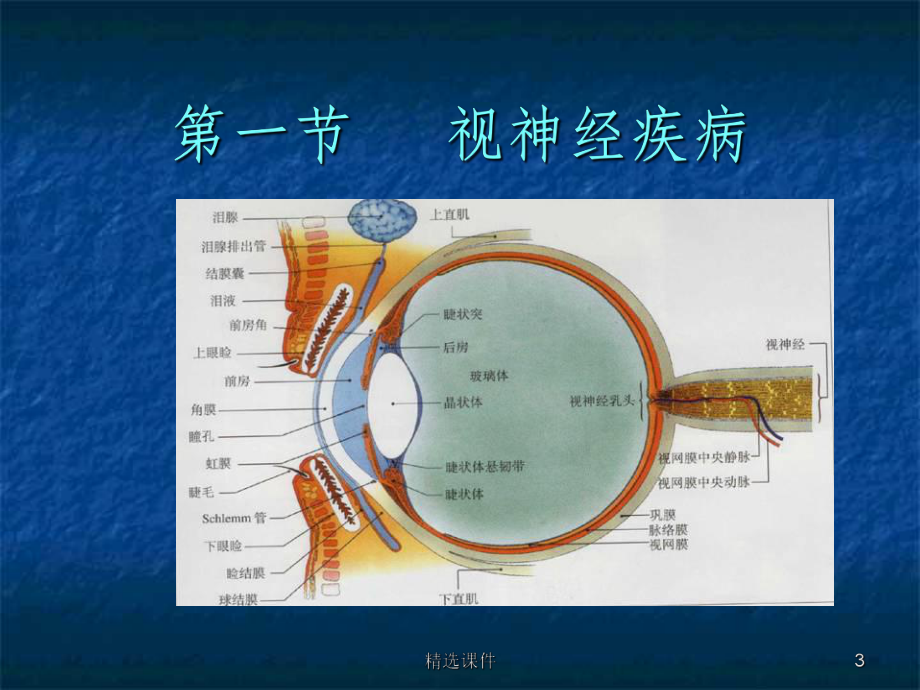 视神经及视路疾病ppt课件.ppt_第3页