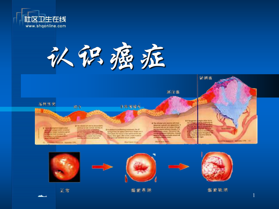 认识癌症PPT课件.ppt_第1页