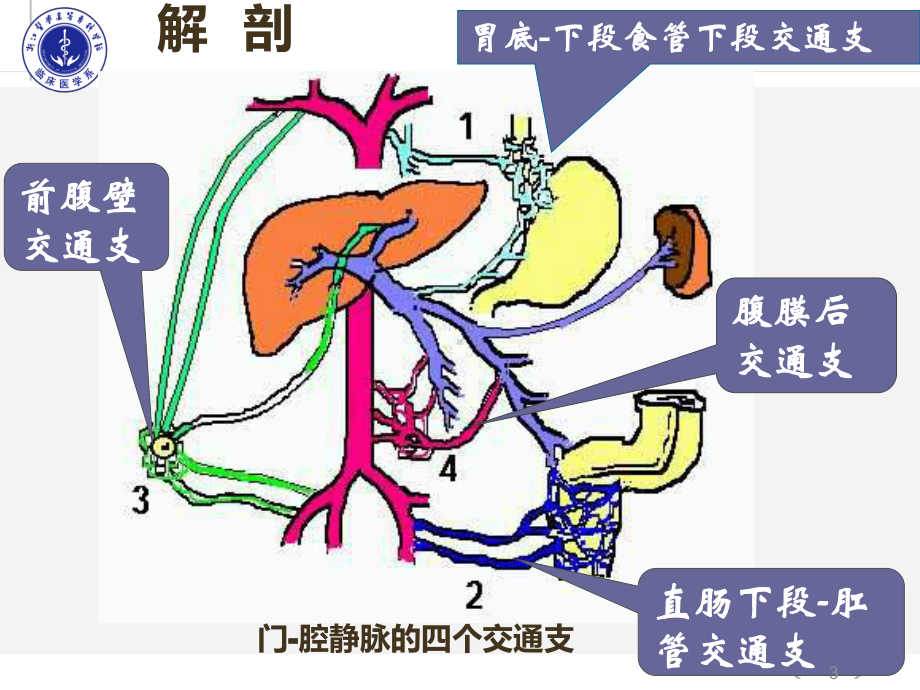 门静脉高压PPT课件.ppt_第3页