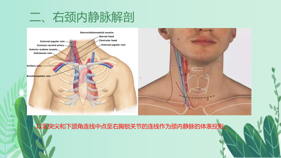 颈内静脉穿刺置管术PPT课件.ppt_第3页