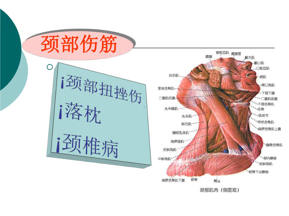 颈部筋伤详解精品PPT课件.pptx_第2页