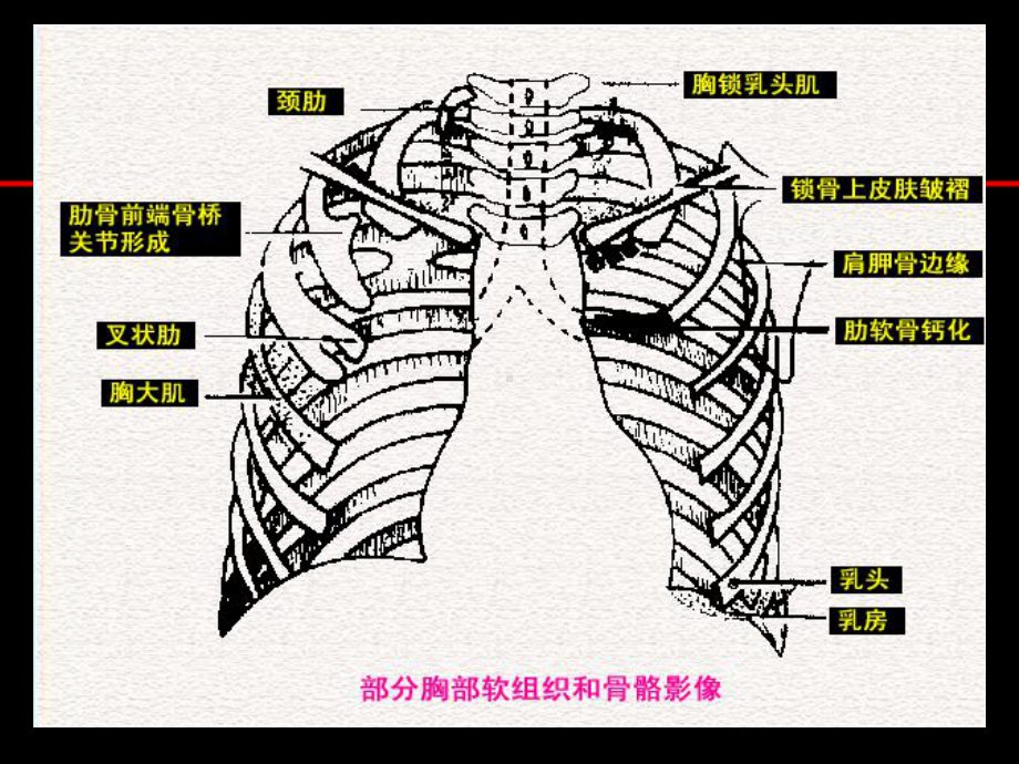 胸片阅读-ppt课件.ppt_第3页