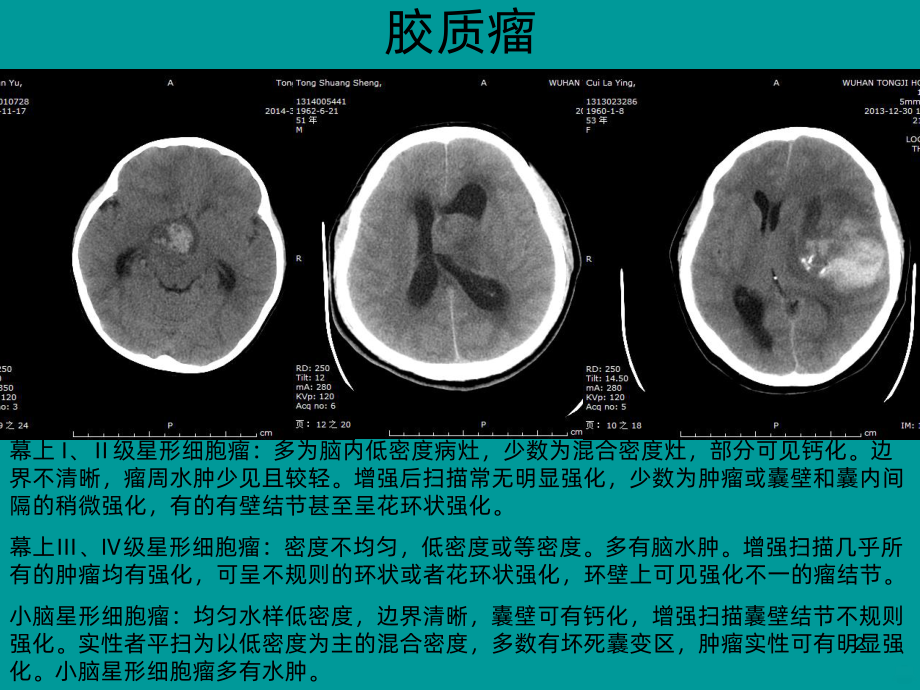 典型病例影像表现PPT课件.ppt_第2页