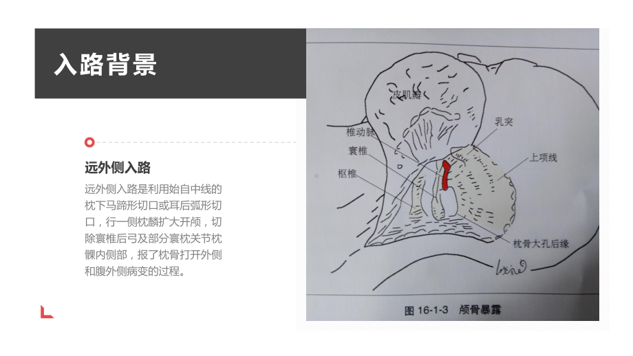 远外侧入路PPT课件.ppt_第3页