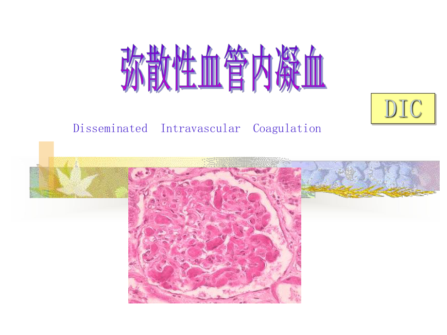 最新DIC完整版PPT课件.ppt_第3页