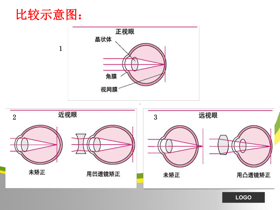 常见病知识修订稿演示课件.ppt_第3页