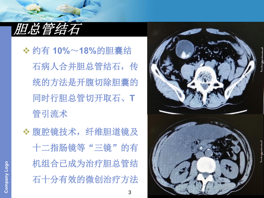 腹腔镜下胆总管切开探查取石术PPT课件.ppt_第3页