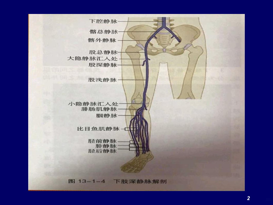 下肢静脉造影PPT课件.ppt_第2页