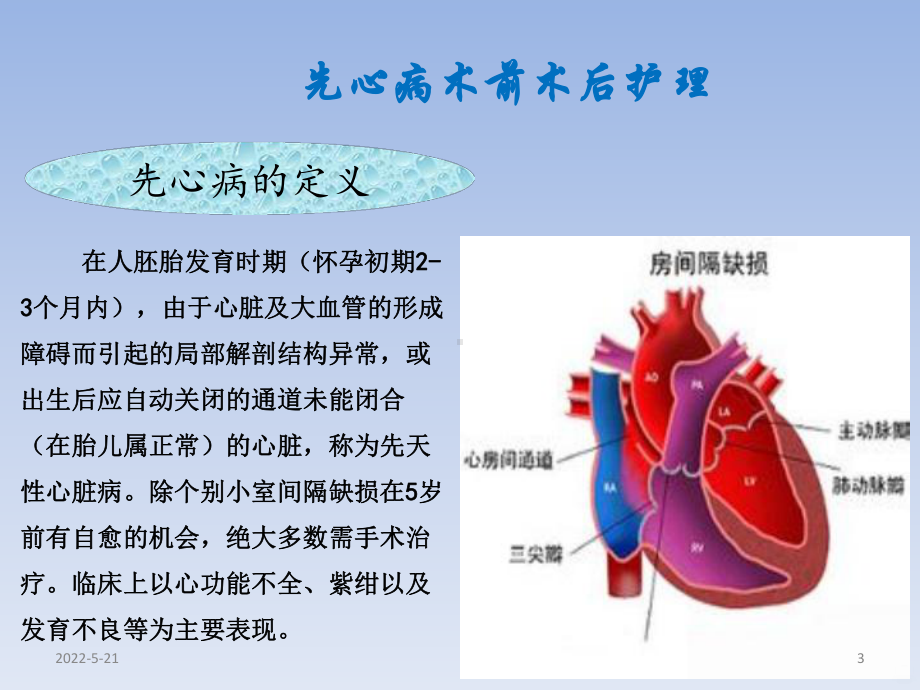 先心病PPT课件(同名255).pptx_第3页