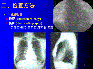 影像ppt课件.ppt