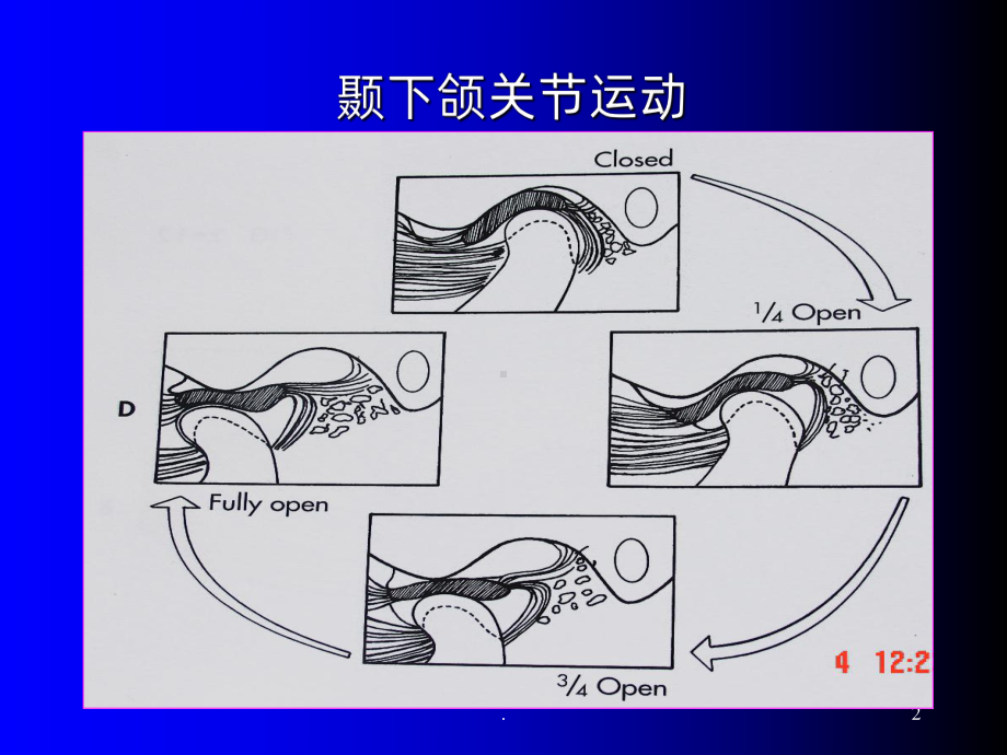 颞下颌关节紊乱MRI表现ppt课件.ppt_第2页