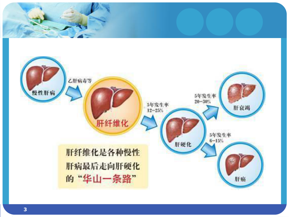 肝纤四项ppt课件.ppt_第3页