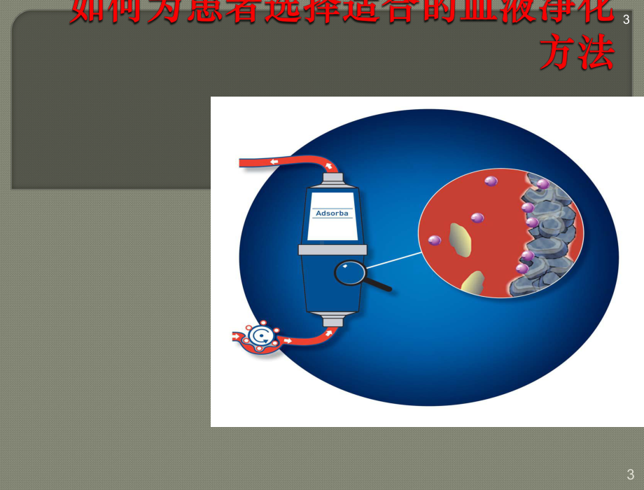 血液灌流ppt课件.ppt_第3页