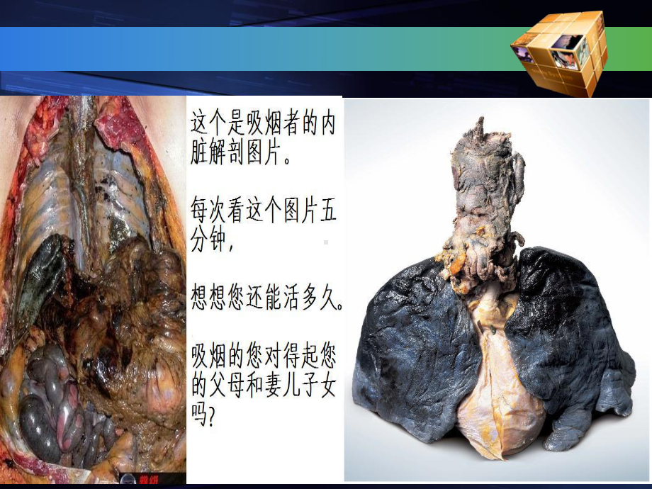 戒烟限酒PPT课件.ppt_第3页