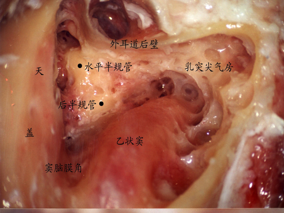 耳的应用解剖及生理学SXJPPT课件.ppt_第3页