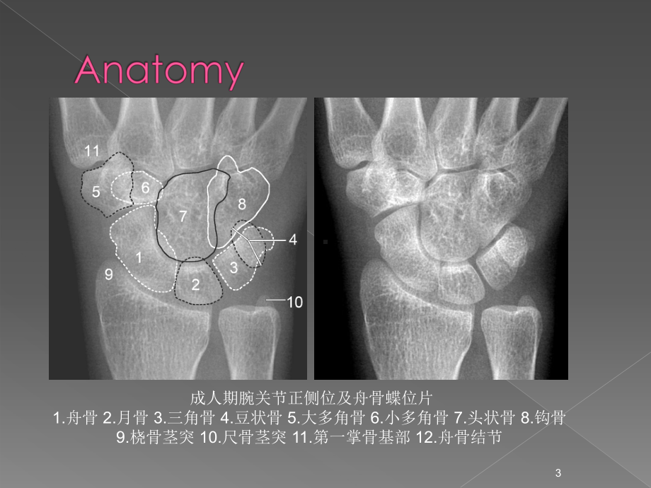 腕关节X线解剖ppt课件.ppt_第3页