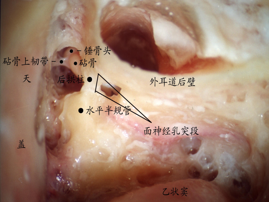 耳的应用解剖及生理学PPT课件.ppt_第3页