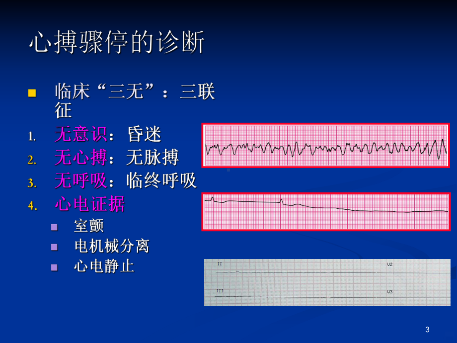 心搏骤停的急救PPT课件.ppt_第3页