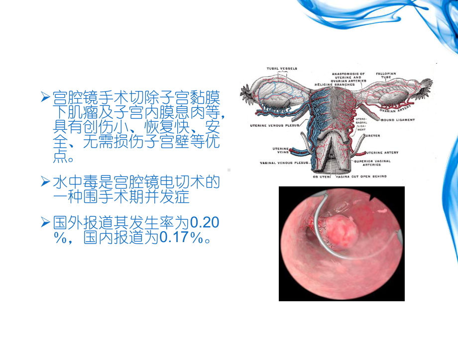 水中毒PPT课件.ppt_第2页