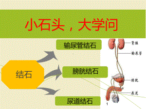 结石疾病培训ppt课件.ppt