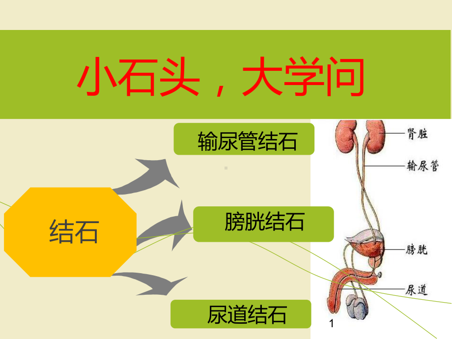 结石疾病培训ppt课件.ppt_第1页