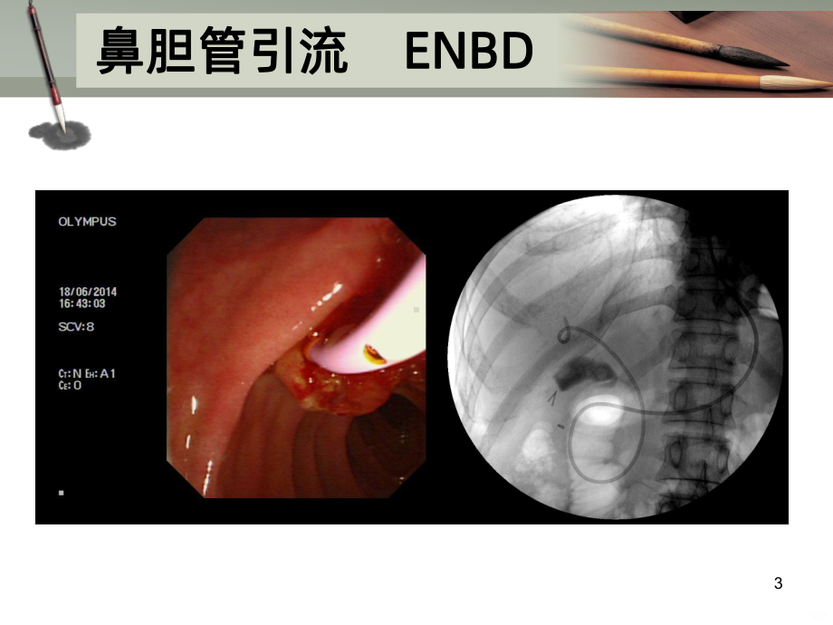 ENBDPPT课件.ppt_第3页