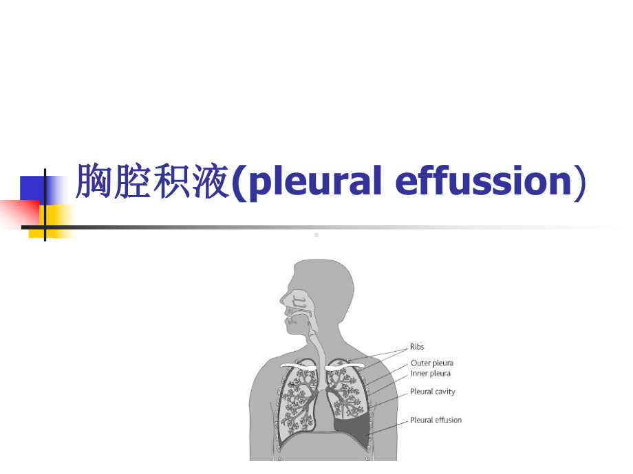 胸水PPT课件.ppt_第1页