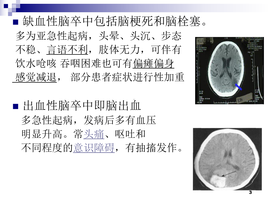 脑卒中的识别及急救ppt课件.ppt_第3页