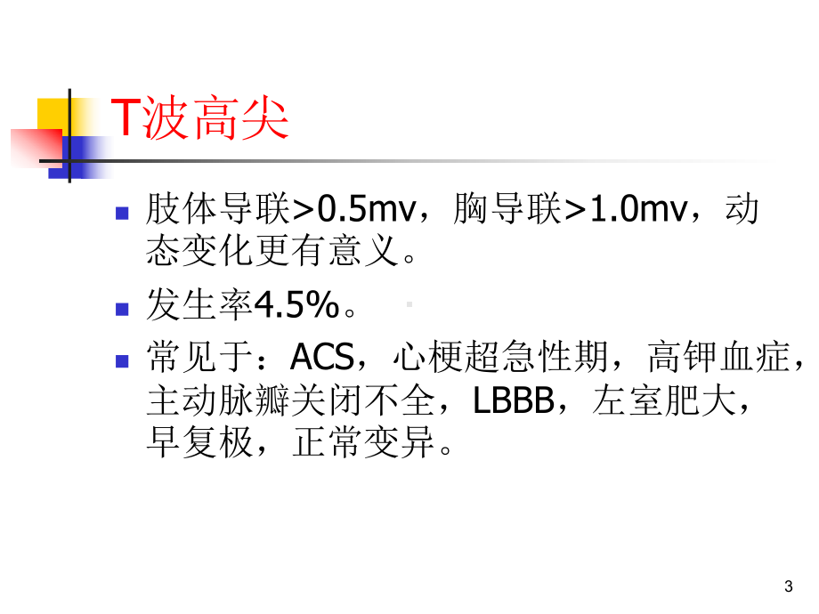 多变的T波PPT课件.ppt_第3页