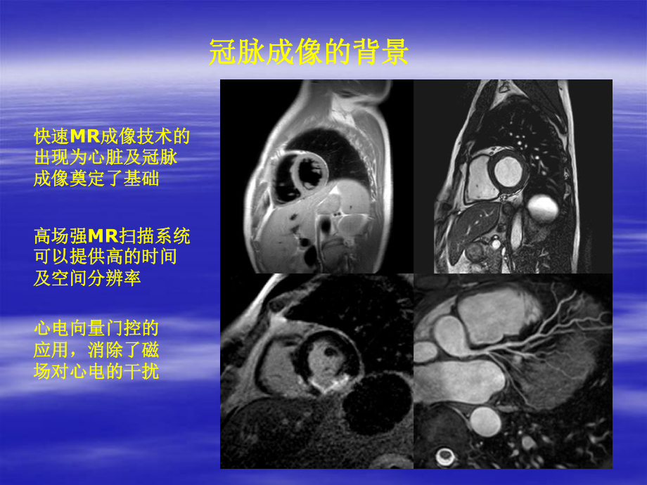 mrca-whole-Heart精品PPT课件.pptx_第2页