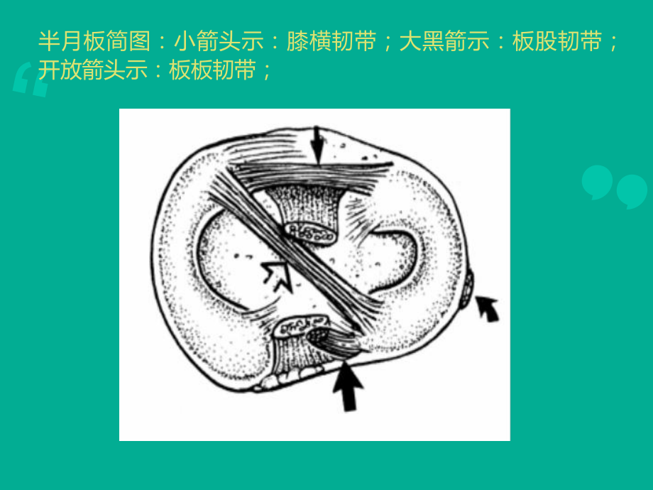 膝关节MRI解剖-ppt课件.ppt_第3页