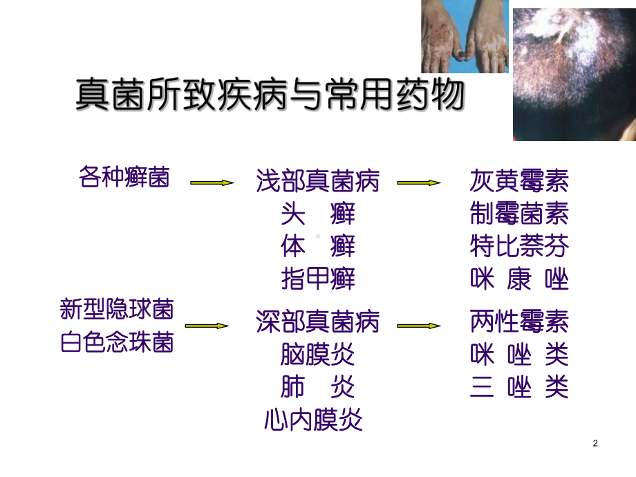 抗真菌药PPT课件.ppt_第2页