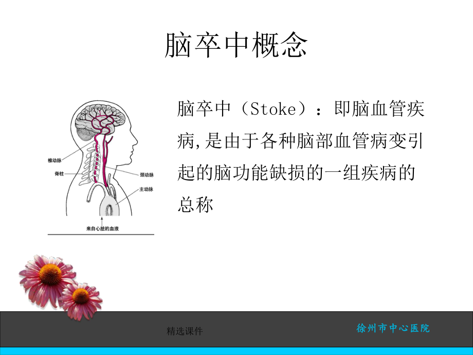 脑卒中患者安全隐患PPT课件.ppt_第2页