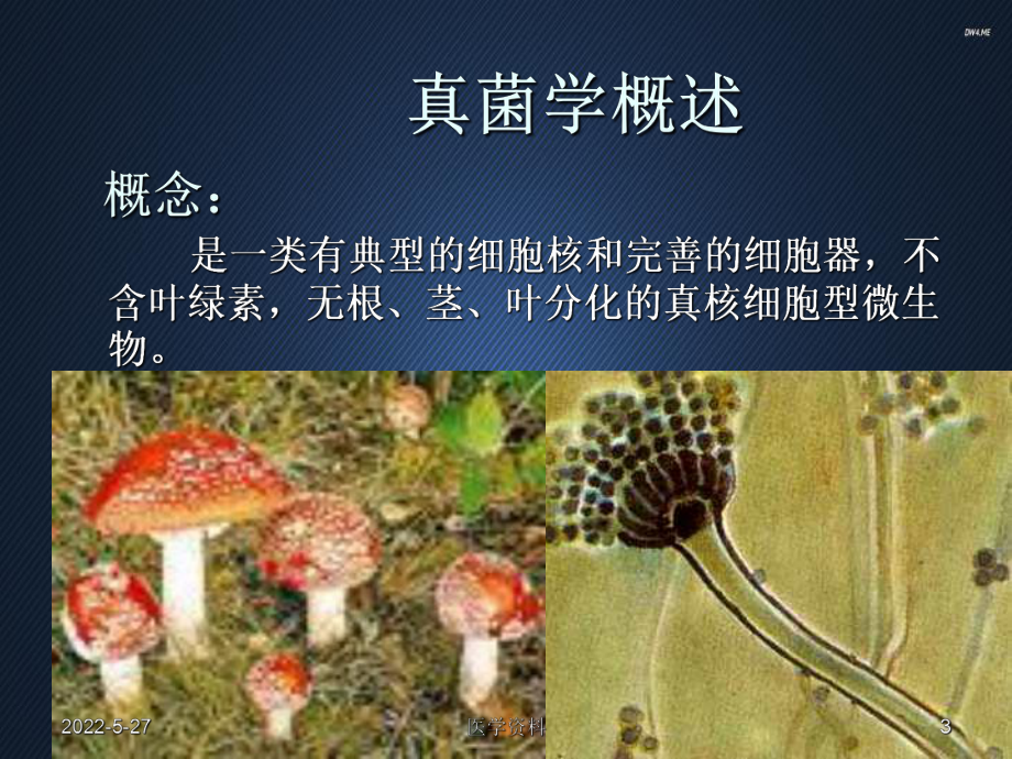 白假丝酵母菌-ppt课件.ppt_第3页