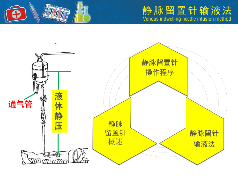 静脉留置针输液-ppt课件.ppt_第2页