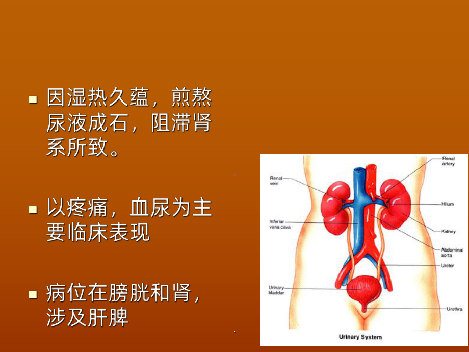 石淋ppt课件.ppt_第2页