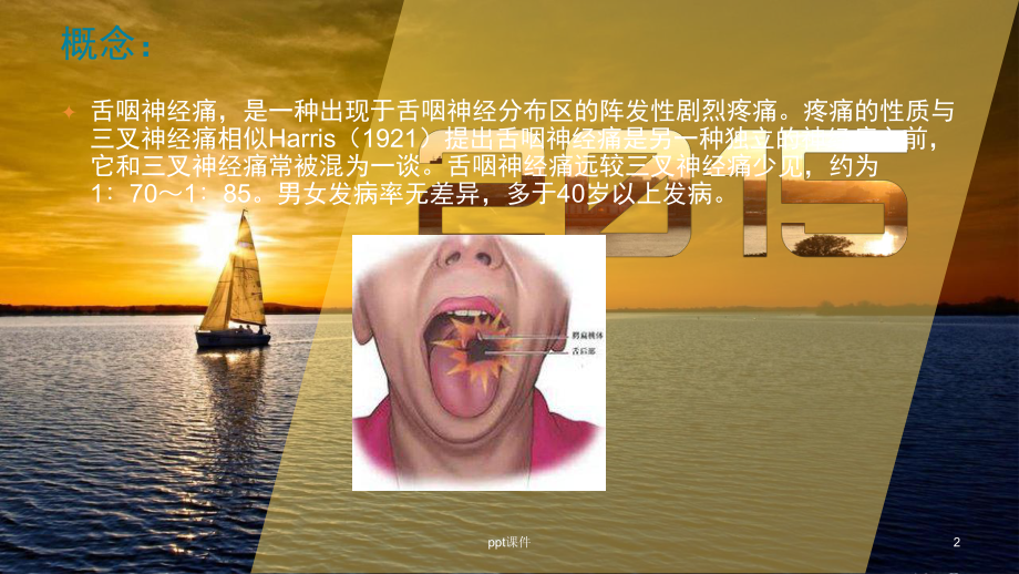 舌咽神经痛-ppt课件.ppt_第2页